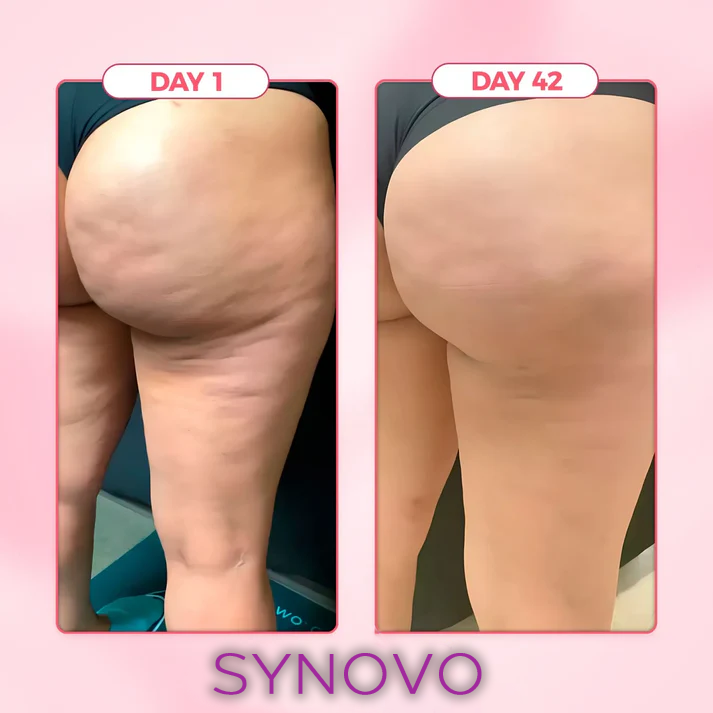 Flolegs by Synovo -   The celebs Anti-cellulite tights